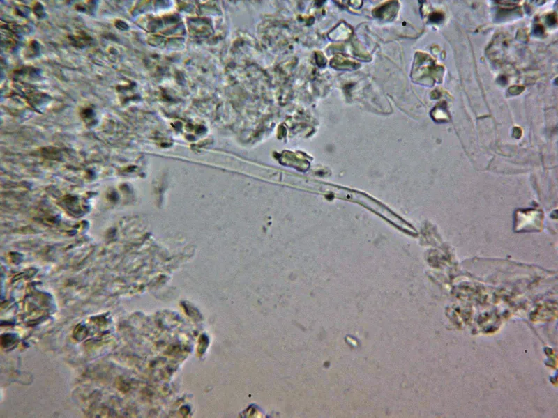 Cheimonophyllum candidissimum 10 -  Queilocistidfio filiforme